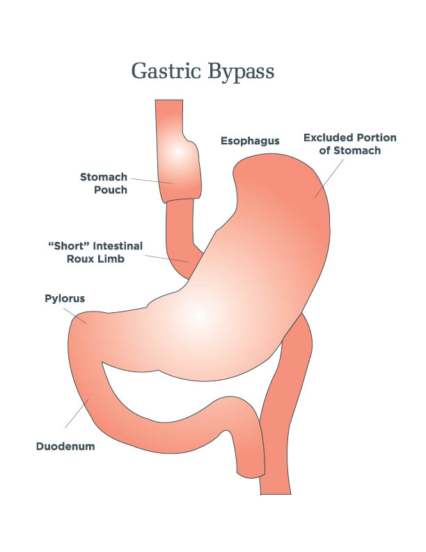 diabetes weight loss drug